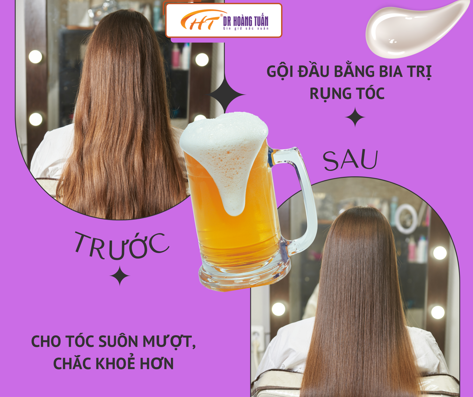 Gội đầu bằng bia trị rụng tóc