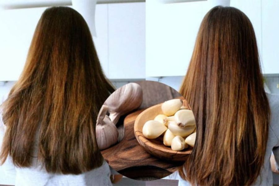 Tỏi trị hói đầu
