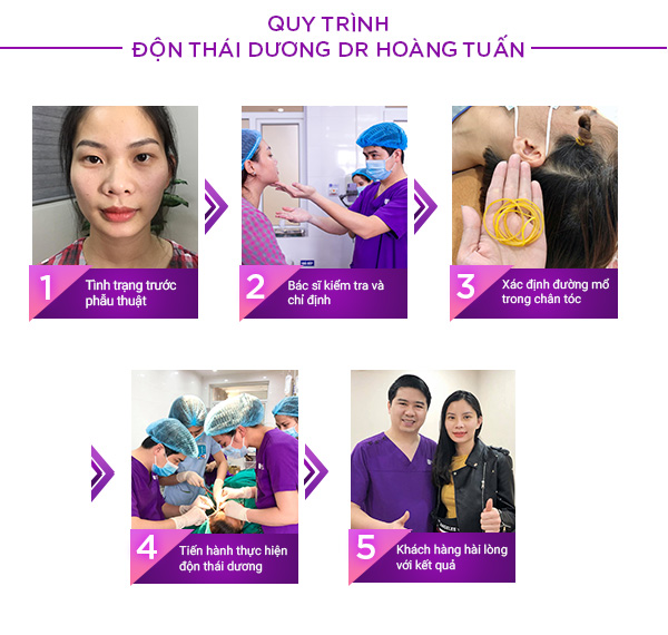 Quy trình độn thái dương 