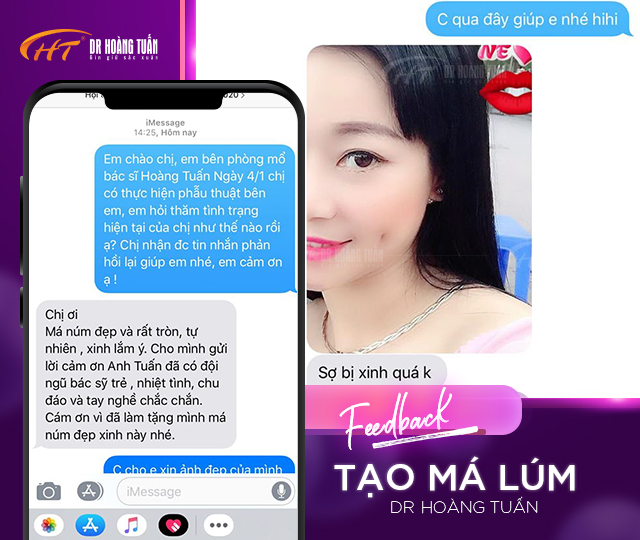 Feedback của khách hàng về tạo má lúm đồng tiền tại Dr Hoàng Tuấn