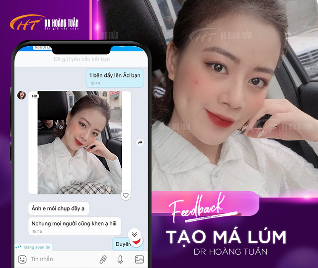 Feedback của khách hàng về tạo má lúm đồng tiền tại Dr Hoàng Tuấn