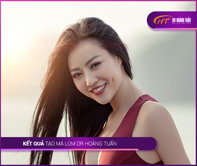 Hình ảnh kết quả tạo má lúm đồng tiền