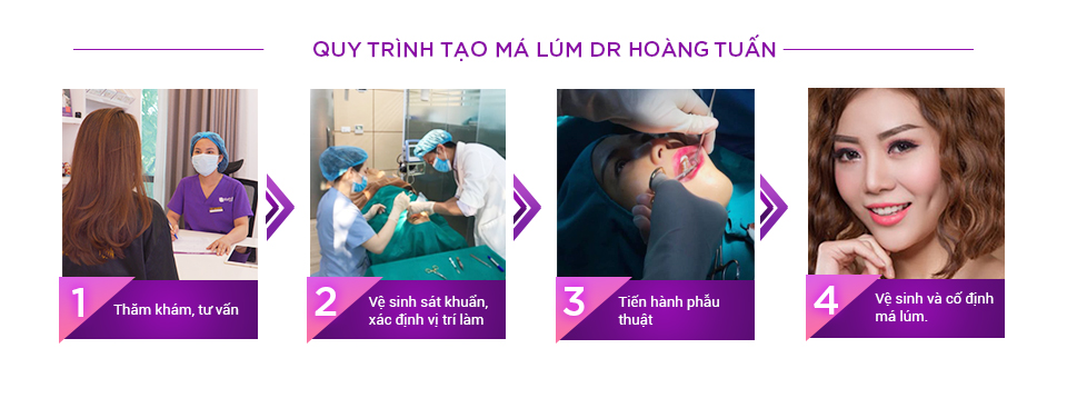 Quy trình tạo má lúc đồng tiền 