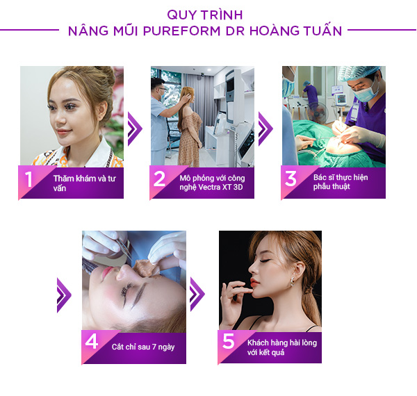 quy trình nâng mũi Pureform