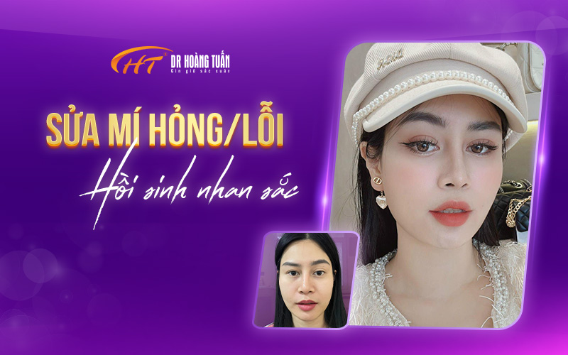 sửa mí