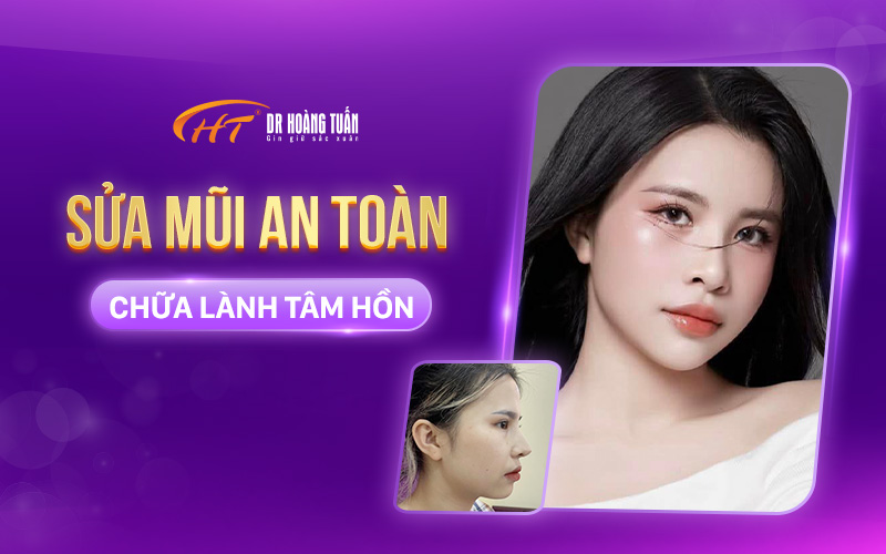 Sửa mũi hỏng tại Dr Hoàng Tuấn