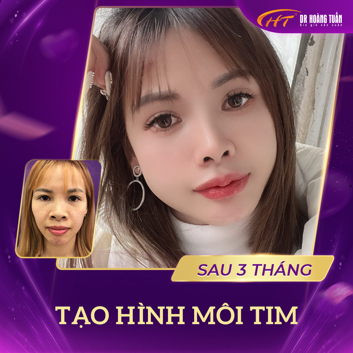 Tạo hình môi trái tim