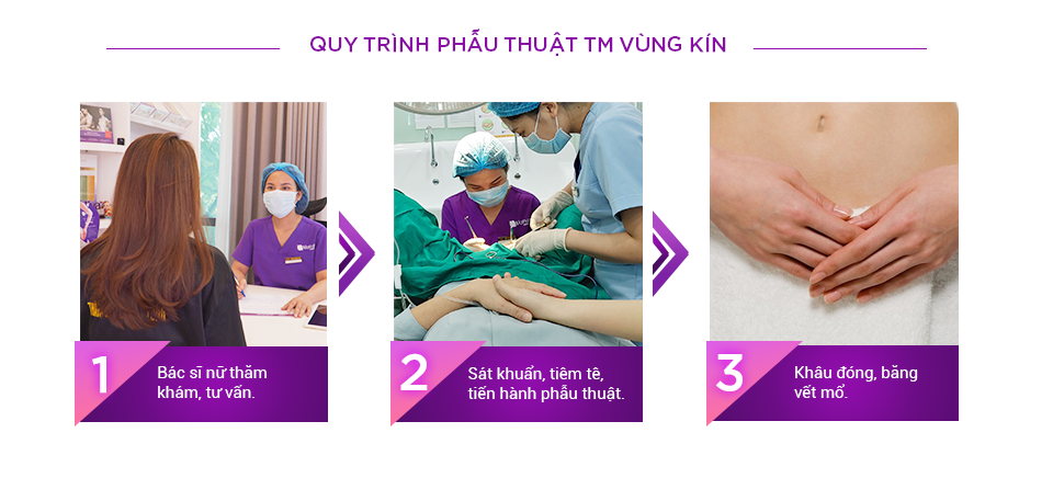 Quy trình thẩm mỹ vùng kín 