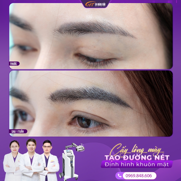 Cấy lông mày ở đâu? Cấy lông mày ở đâu uy tín tại Hà Nội?