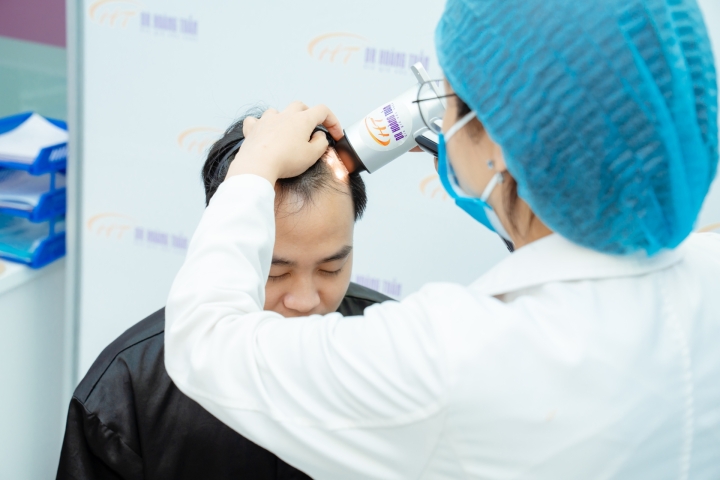 Phòng ngừa hói đầu từ sớm - Bí quyết giữ mái tóc dày khoẻ